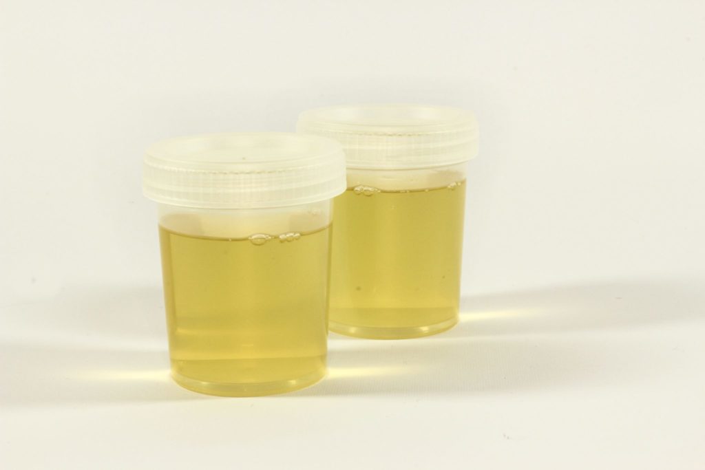 test, a container for urine, urine